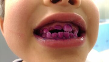 子どもが歯みがきをしっかりできる方法　2017年3月公開記事 ｜きらぼしstudy online
